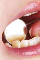 Kranke Zähne & Behandlung